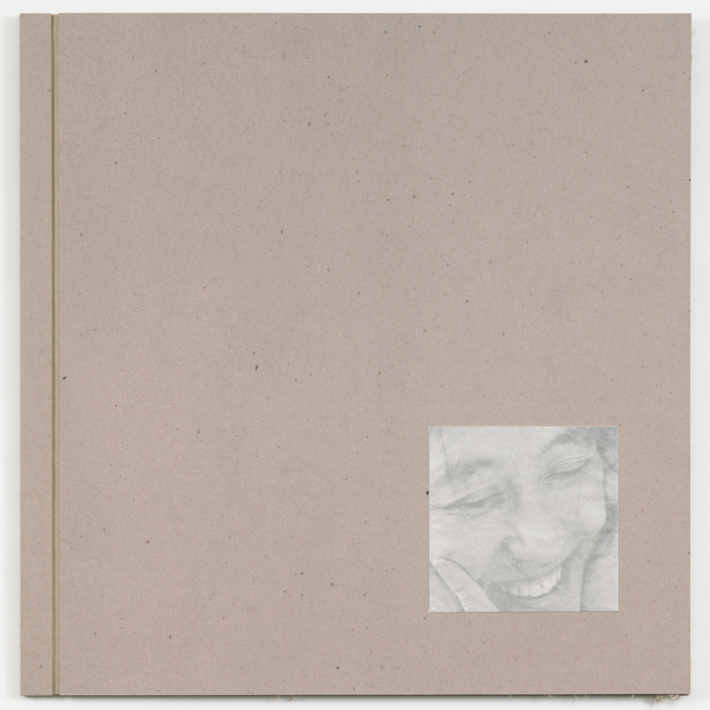 Kiki Smith. Endocrinology. 1997