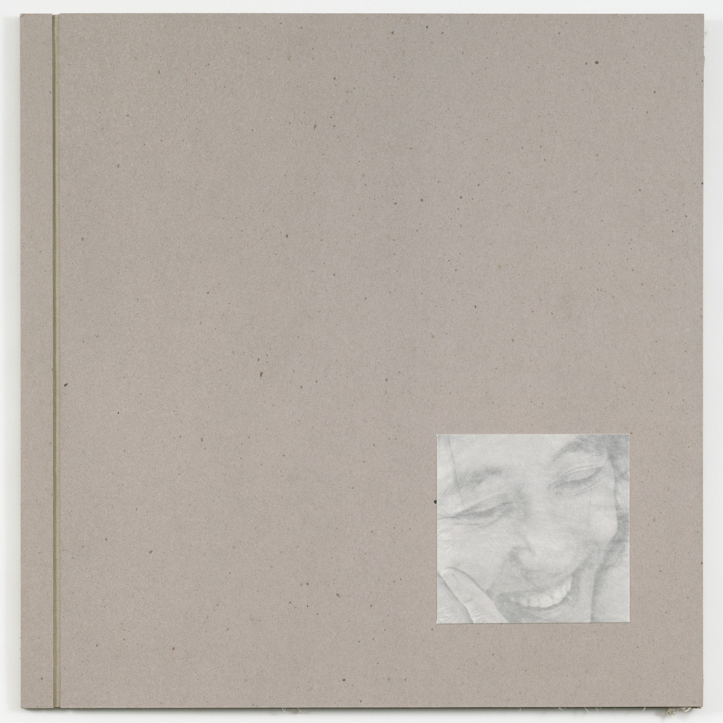 Kiki Smith. Endocrinology. 1997