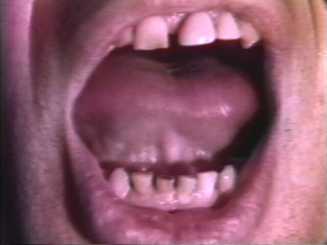 Vito Acconci. Open Book