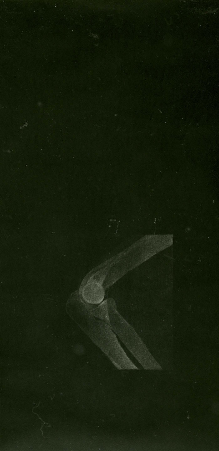 Troy Brauntuch. Untitled. 1981