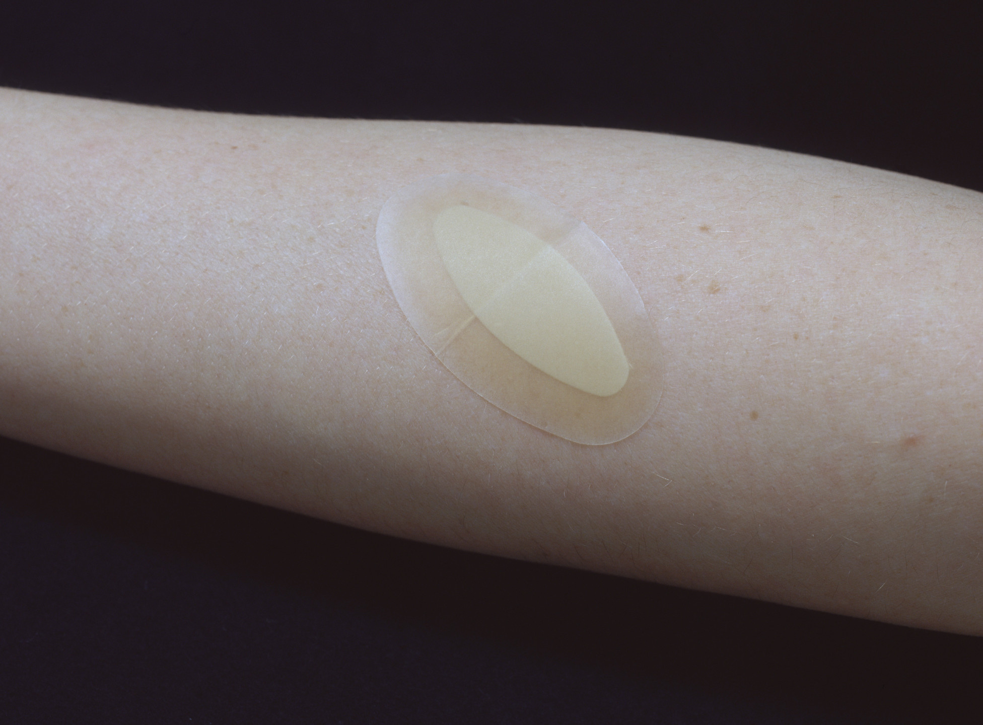 Coloplast A/S. Band-Aid Advanced Healing Blister. 2001