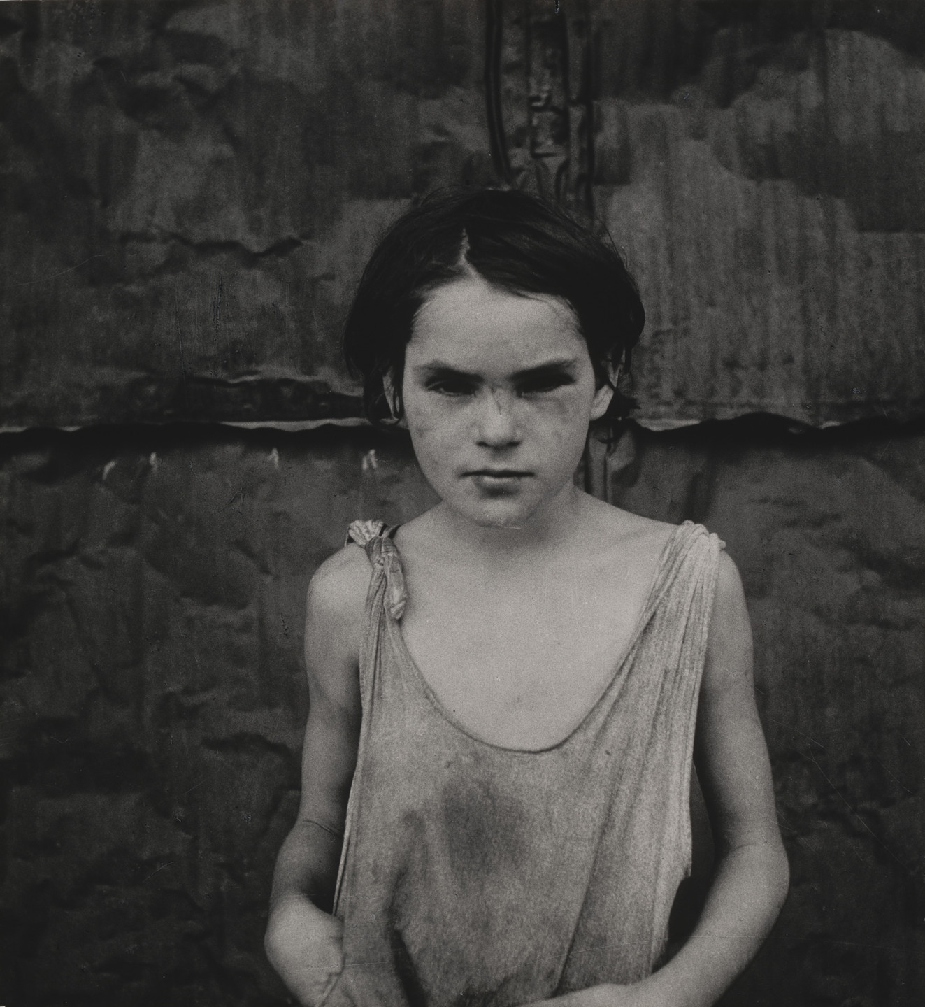 Dorothea Lange. Damaged Child, Shacktown, Elm Grove, Oklahoma. August 1936