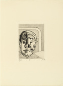 Otto Dix. Skin Graft (Transplantation) from The War (Der Krieg). (1924)