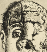 Otto Dix. Skin Graft (Transplantation) from The War (Der Krieg). (1924)