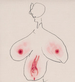 Louise Bourgeois. Untitled, no. 34 of 36, from the series, The Fragile. 2007