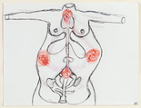 Louise Bourgeois. Medical Horizontal. 1998