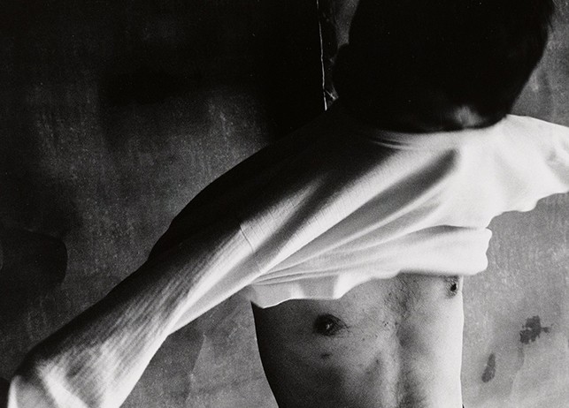 Shomei Tomatsu. Hibakusha Tomitarō Shimotani, Nagasaki (detail). 1961. Gelatin silver print, 13 × 18 3/4" (33 × 47.6 cm). The Museum of Modern Art, New York. Gift of the artist © 2016 Shomei Tomatsu